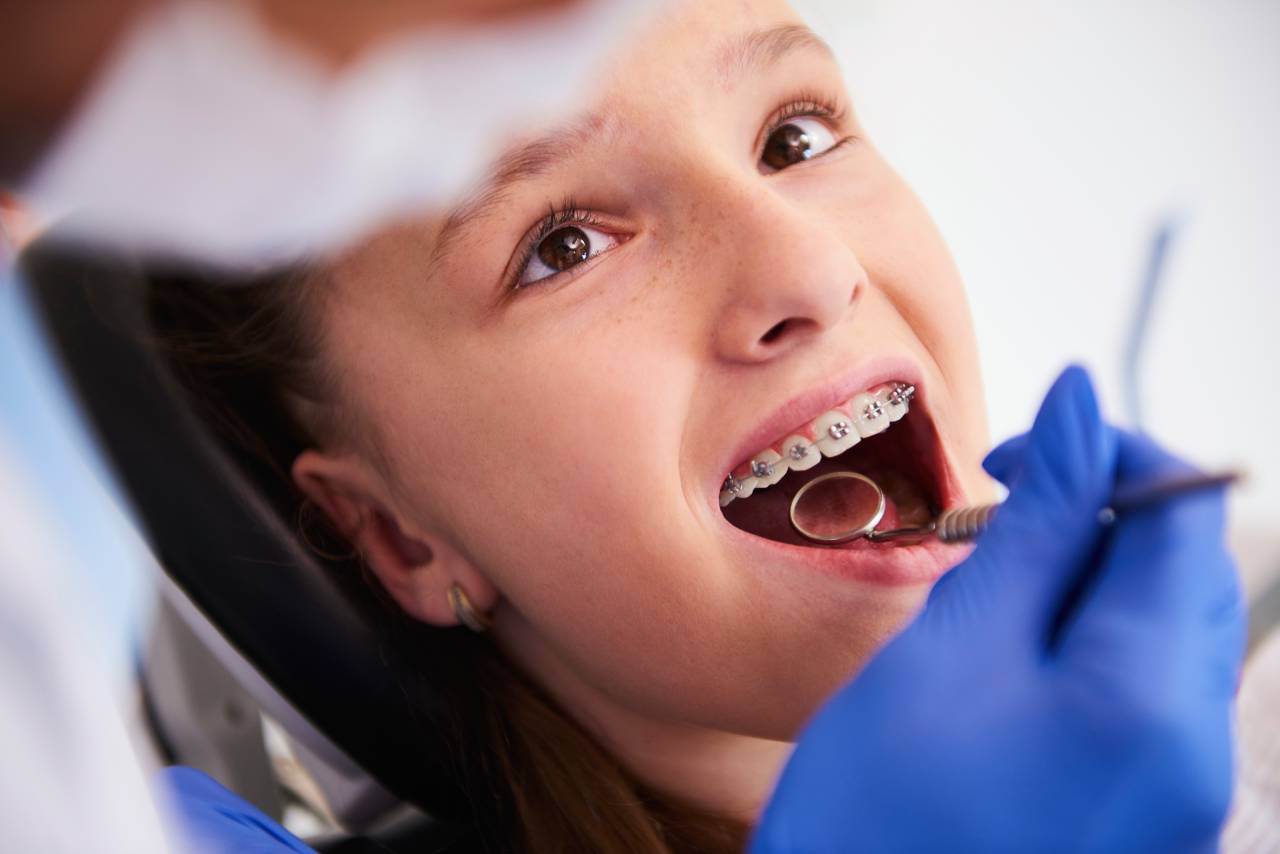 Orthodontic Procedures