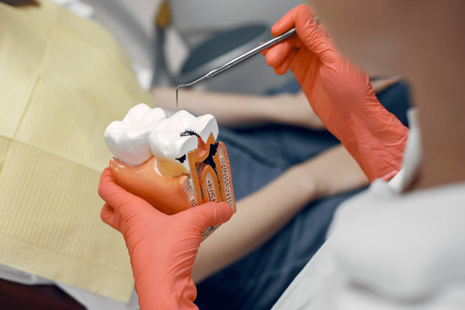 Single Visit Root Canal